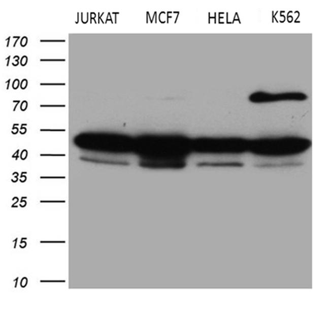 GNAS Antibody in Western Blot (WB)