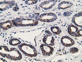 GNB2L1 Antibody in Immunohistochemistry (Paraffin) (IHC (P))