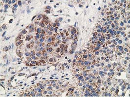 GNB2L1 Antibody in Immunohistochemistry (Paraffin) (IHC (P))