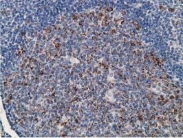 GNB2L1 Antibody in Immunohistochemistry (Paraffin) (IHC (P))