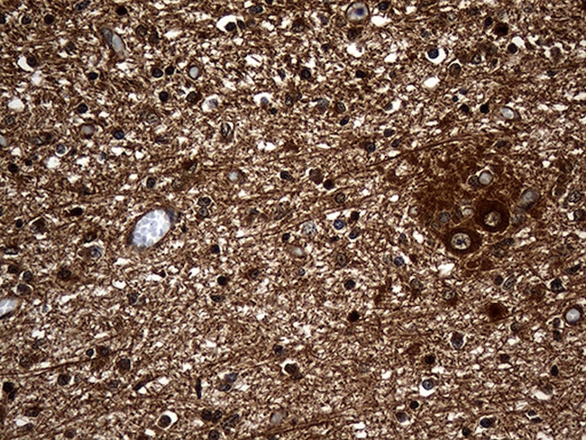 GNPAT Antibody in Immunohistochemistry (Paraffin) (IHC (P))