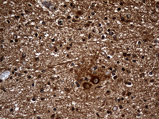 GNPAT Antibody in Immunohistochemistry (Paraffin) (IHC (P))