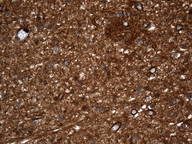 GNPAT Antibody in Immunohistochemistry (Paraffin) (IHC (P))