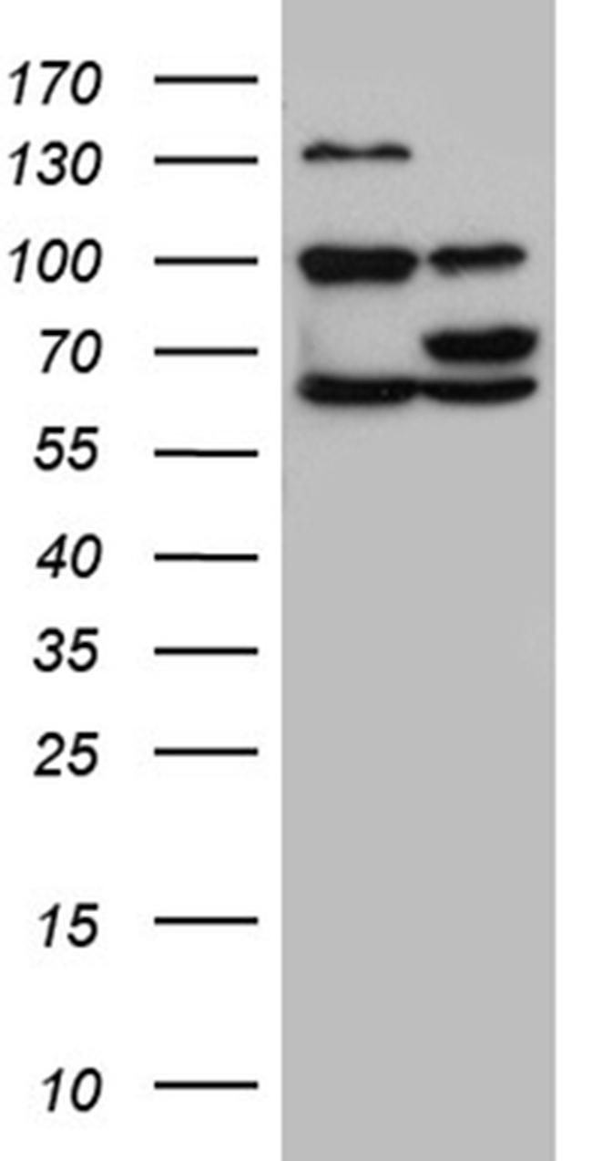 GNPAT Antibody in Western Blot (WB)