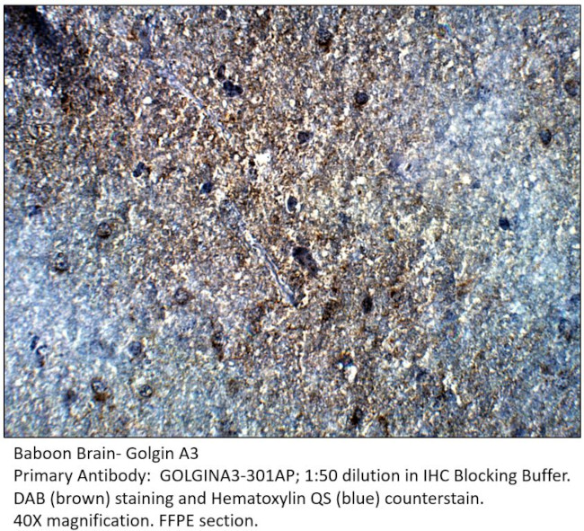 Golgin A3 Antibody in Immunohistochemistry (IHC)