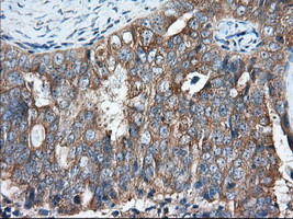 GORASP1 Antibody in Immunohistochemistry (Paraffin) (IHC (P))