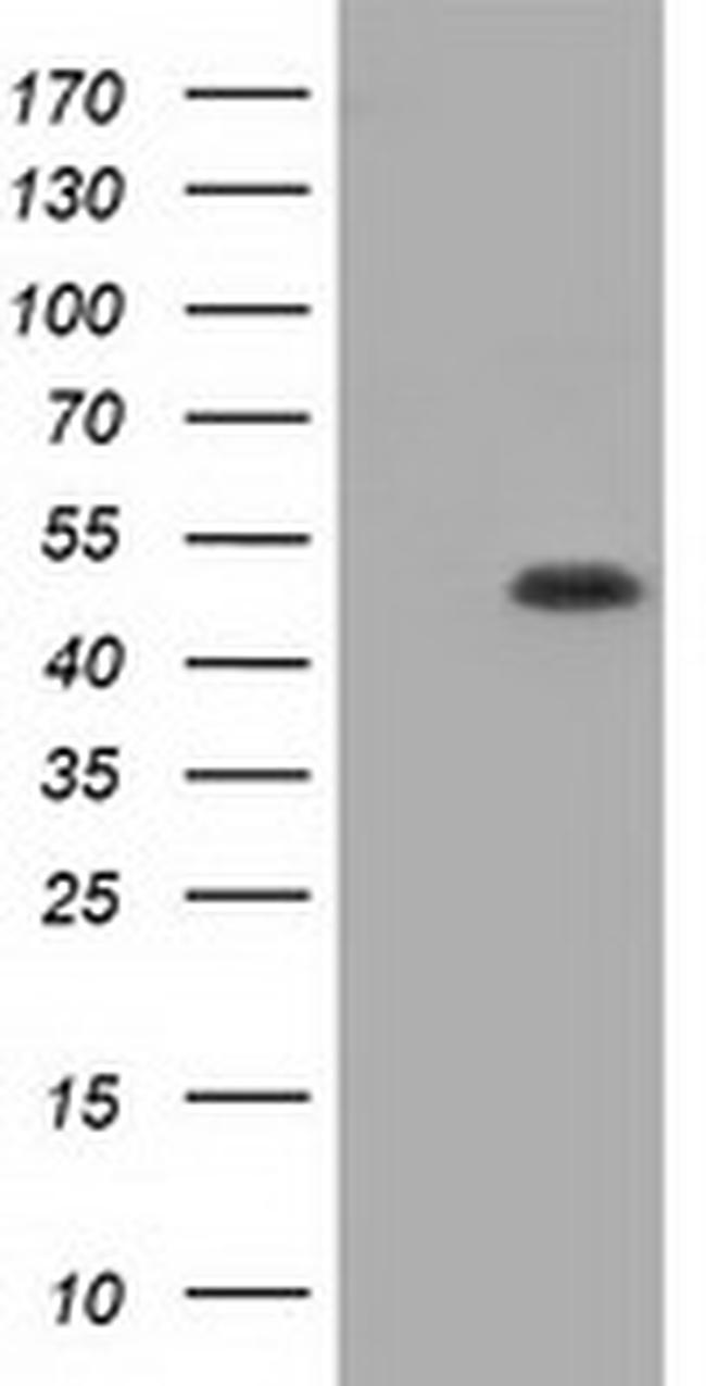 GORASP1 Antibody in Western Blot (WB)