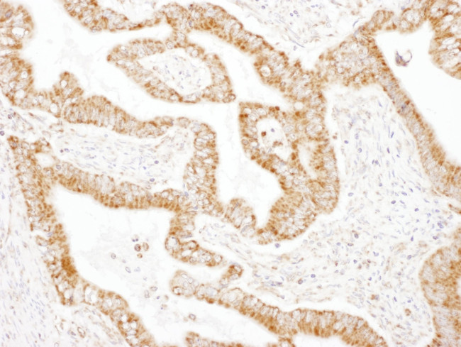 GOT2 Antibody in Immunohistochemistry (IHC)