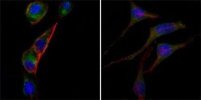 GOT2 Antibody in Immunocytochemistry (ICC/IF)