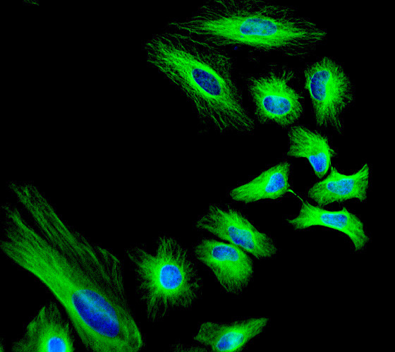 Rat IgG (H+L) Highly Cross-Adsorbed Secondary Antibody in Immunocytochemistry (ICC/IF)