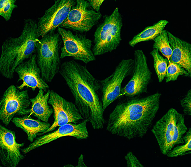 Rat IgG (H+L) Highly Cross-Adsorbed Secondary Antibody in Immunocytochemistry (ICC/IF)