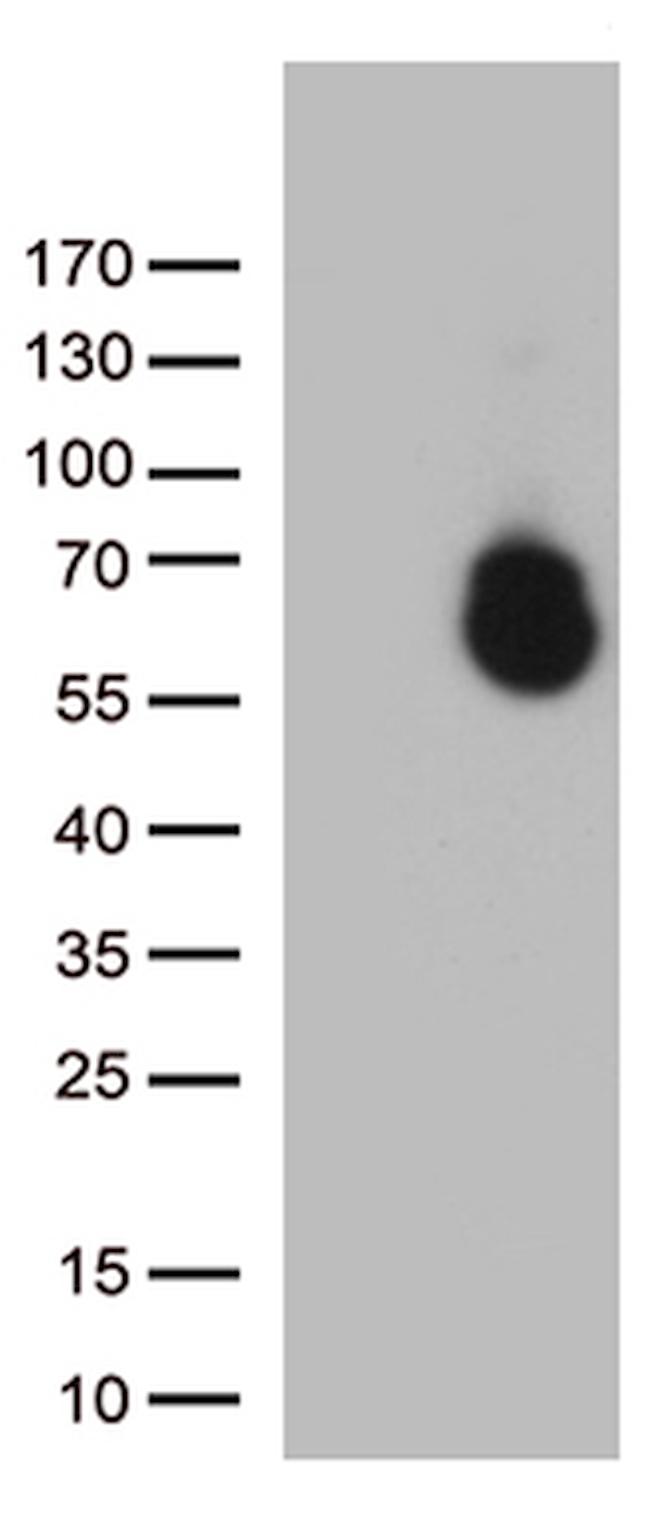 GPC1 Antibody in Western Blot (WB)