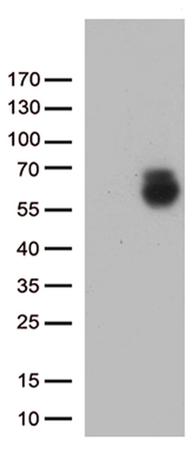 GPC1 Antibody in Western Blot (WB)