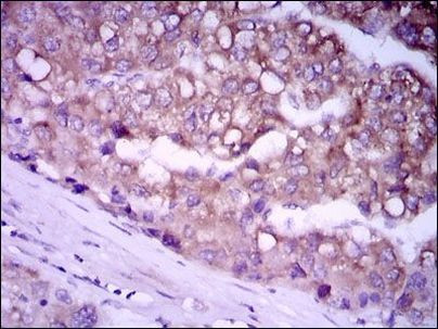 Glypican 3 Antibody in Immunohistochemistry (Paraffin) (IHC (P))