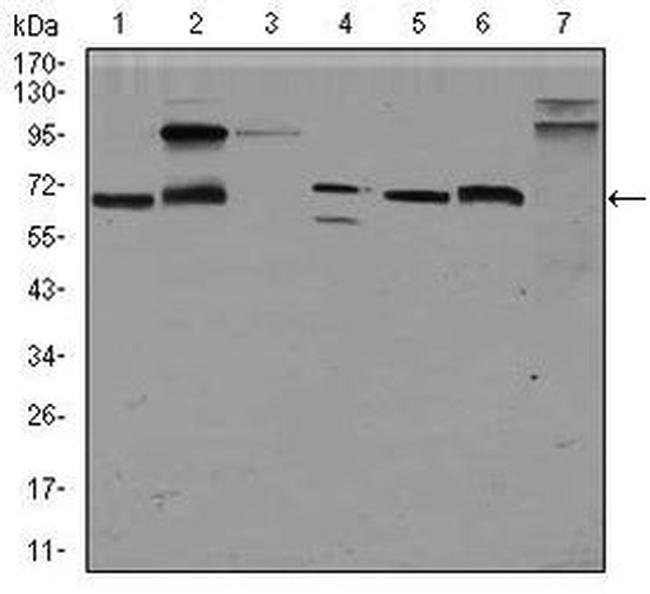 Glypican 3 Antibody in Western Blot (WB)