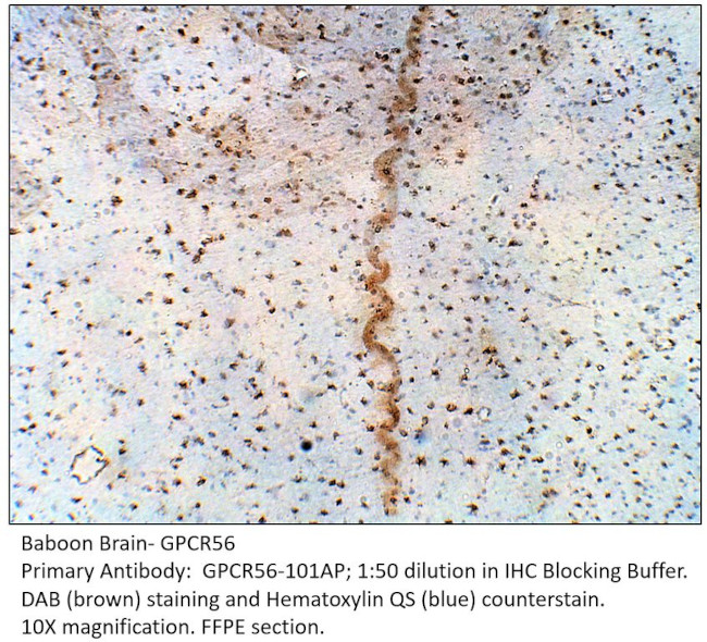 GPR56 Extracellular domain Antibody in Immunohistochemistry (IHC)