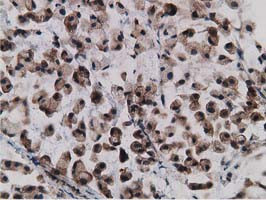 GPHN Antibody in Immunohistochemistry (Paraffin) (IHC (P))