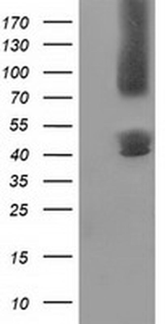 GPHN Antibody in Western Blot (WB)