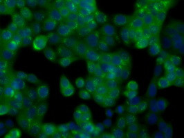 GPI Antibody in Immunocytochemistry (ICC/IF)