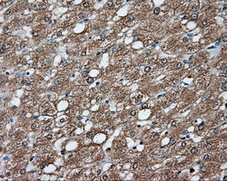 GPI Antibody in Immunohistochemistry (Paraffin) (IHC (P))