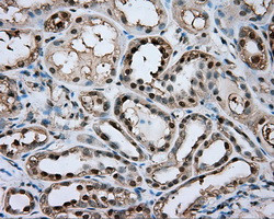 GPI Antibody in Immunohistochemistry (Paraffin) (IHC (P))