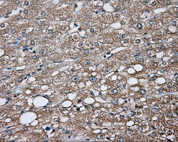 GPI Antibody in Immunohistochemistry (Paraffin) (IHC (P))