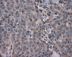 GPI Antibody in Immunohistochemistry (Paraffin) (IHC (P))