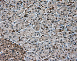 GPI Antibody in Immunohistochemistry (Paraffin) (IHC (P))