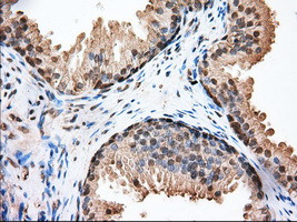 GPI Antibody in Immunohistochemistry (Paraffin) (IHC (P))