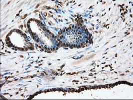 GPI Antibody in Immunohistochemistry (Paraffin) (IHC (P))