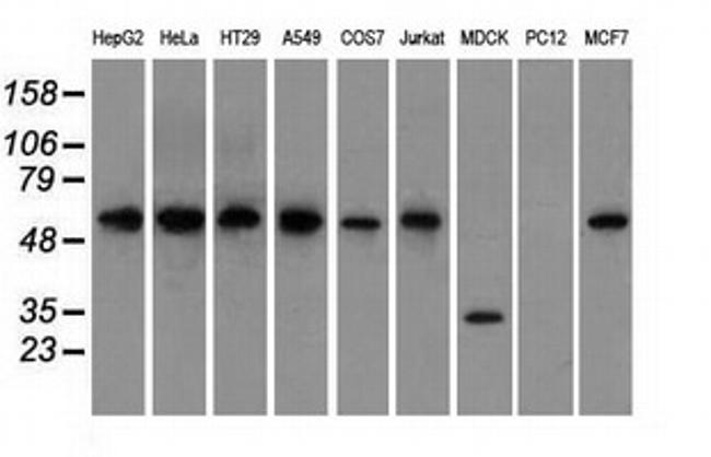 GPI Antibody in Western Blot (WB)