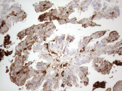 GPNMB Antibody in Immunohistochemistry (Paraffin) (IHC (P))