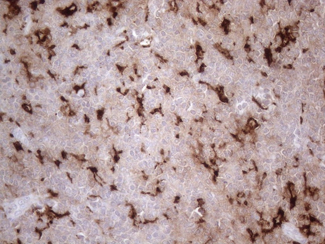 GPNMB Antibody in Immunohistochemistry (Paraffin) (IHC (P))