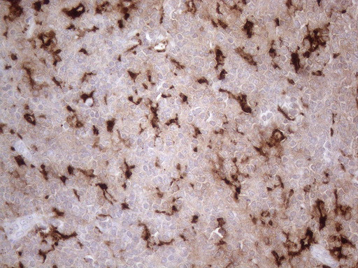 GPNMB Antibody in Immunohistochemistry (Paraffin) (IHC (P))