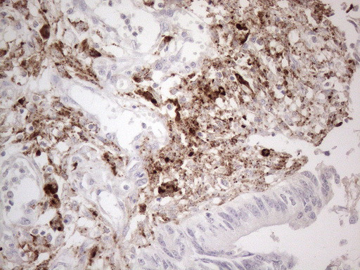 GPNMB Antibody in Immunohistochemistry (Paraffin) (IHC (P))