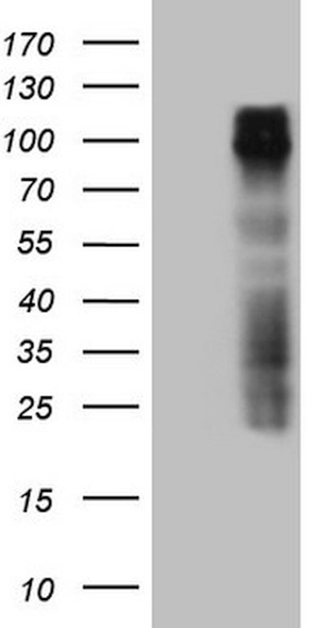 GPNMB Antibody in Western Blot (WB)