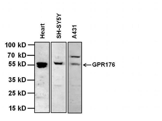 GPR176 Antibody in Western Blot (WB)