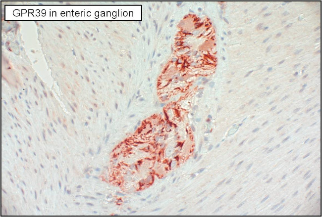 GPR39 Antibody in Immunohistochemistry (Paraffin) (IHC (P))