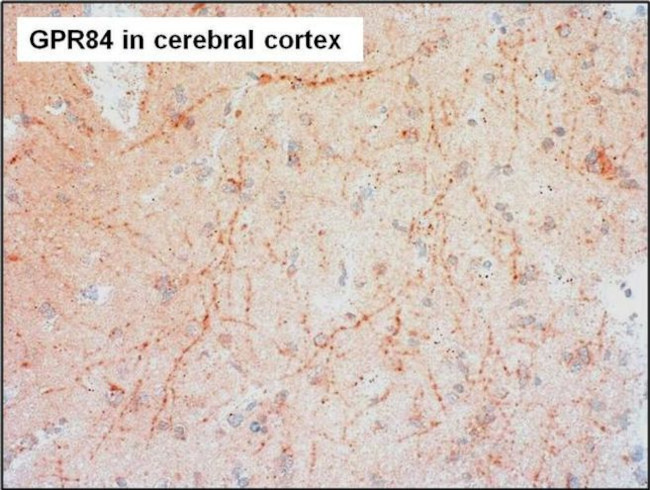 GPR84 Antibody in Immunohistochemistry (Paraffin) (IHC (P))