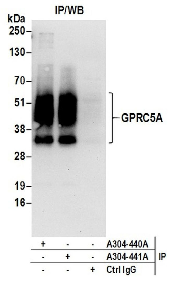 GPRC5A Antibody in Immunoprecipitation (IP)