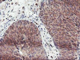 GRAP2 Antibody in Immunohistochemistry (Paraffin) (IHC (P))