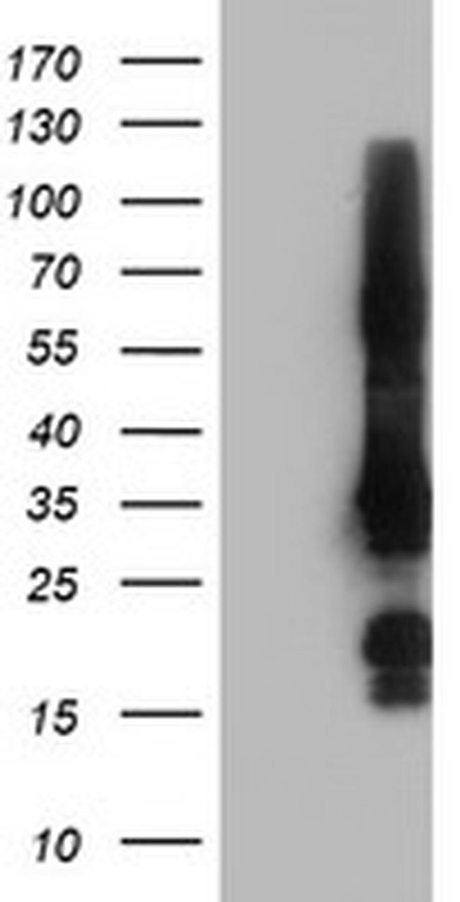 GRAP2 Antibody in Western Blot (WB)