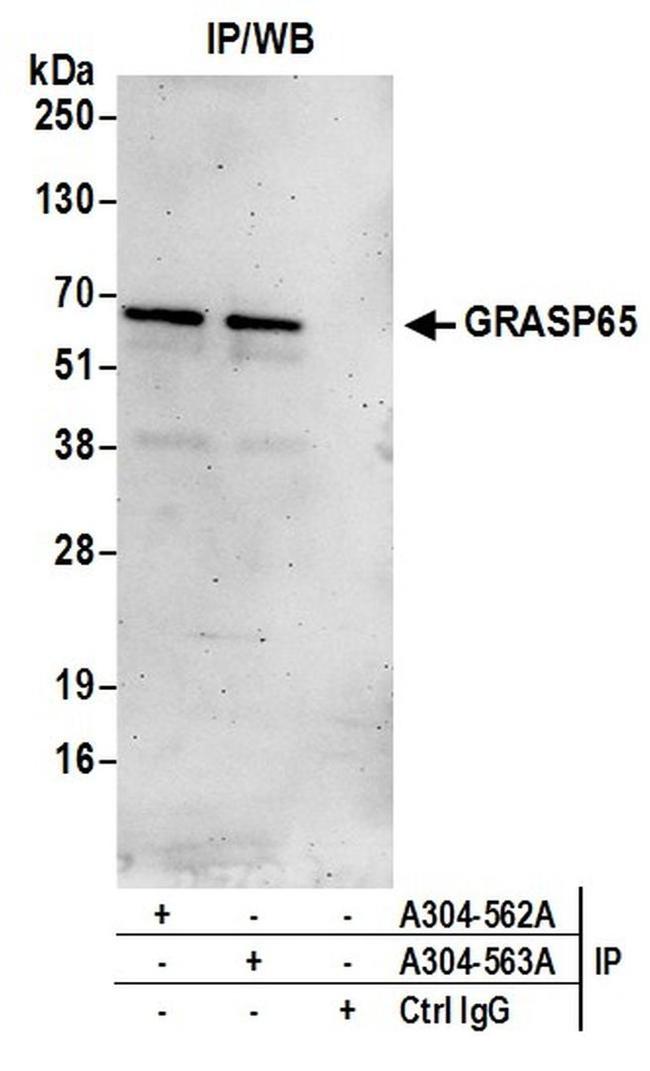 GRASP65 Antibody in Western Blot (WB)