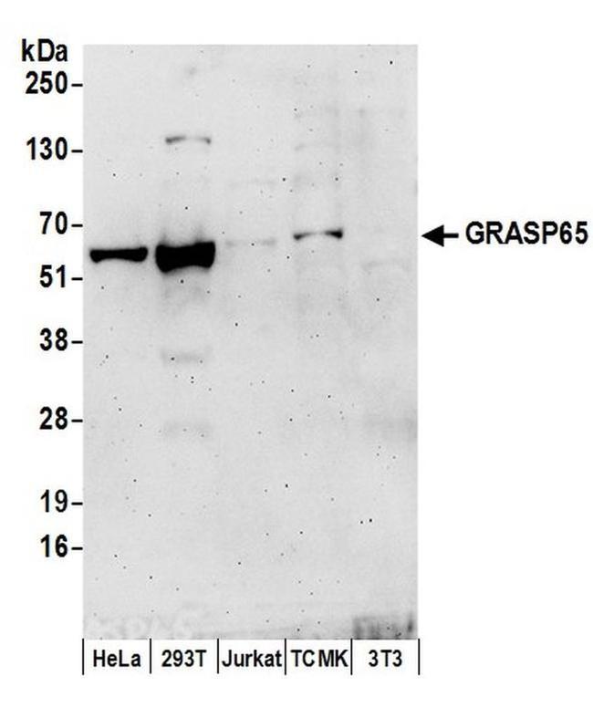 GRASP65 Antibody in Western Blot (WB)