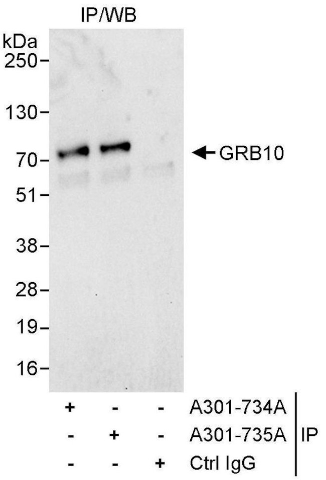 GRB10 Antibody in Immunoprecipitation (IP)