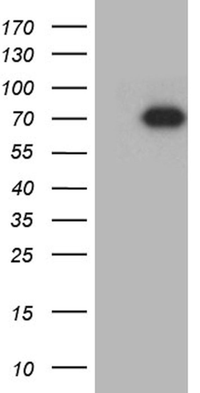 GRB10 Antibody in Western Blot (WB)