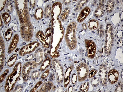 GRB7 Antibody in Immunohistochemistry (Paraffin) (IHC (P))