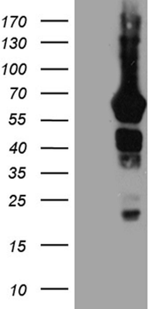 GRB7 Antibody in Western Blot (WB)