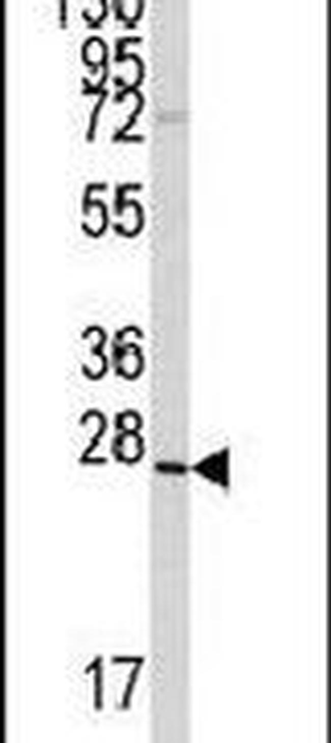 GREM1 Antibody in Western Blot (WB)