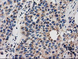 GRHPR Antibody in Immunohistochemistry (Paraffin) (IHC (P))